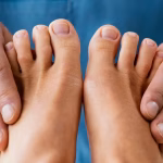 Common Foot Problems A Podiatrist Treats